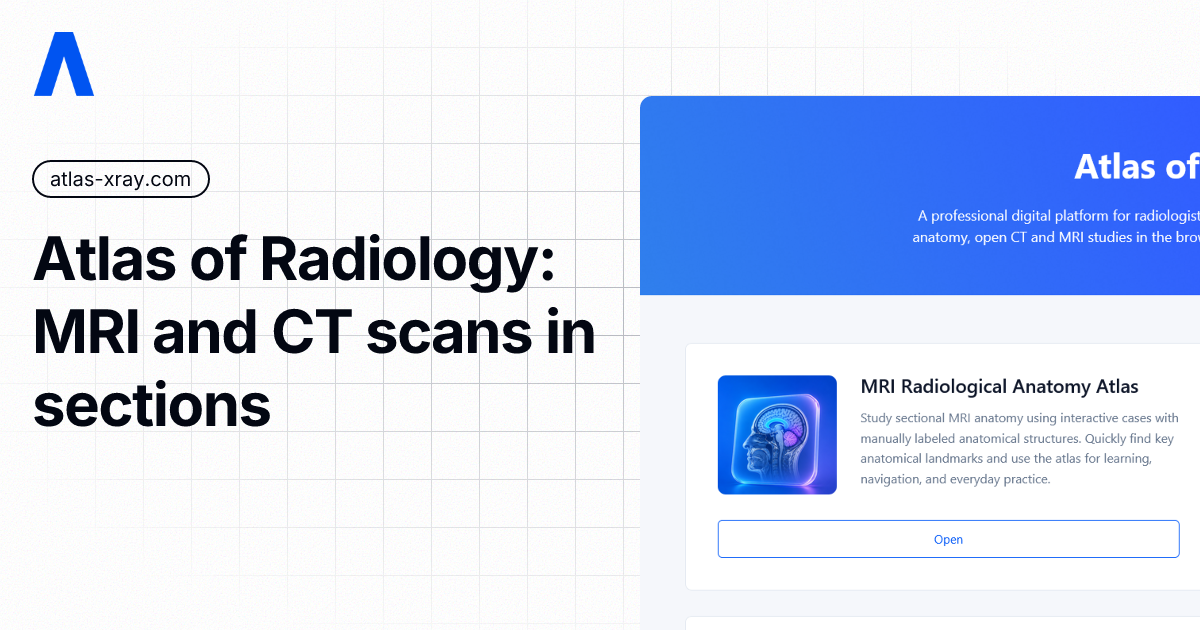 Atlas of Radiology: MRI and CT scans in sections